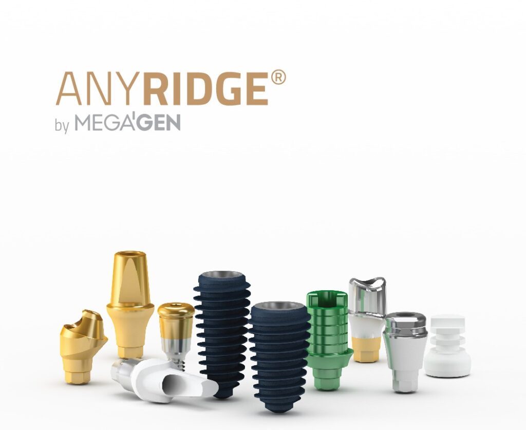 Anyridge implantai