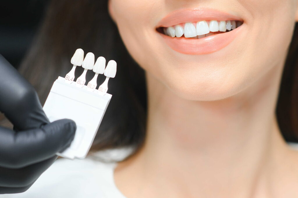 priekinio danties implantas