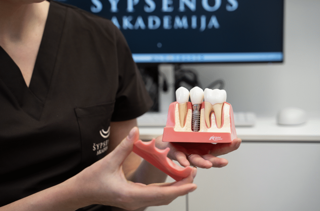 TOP 5 klausimai prieš dantų implantaciją